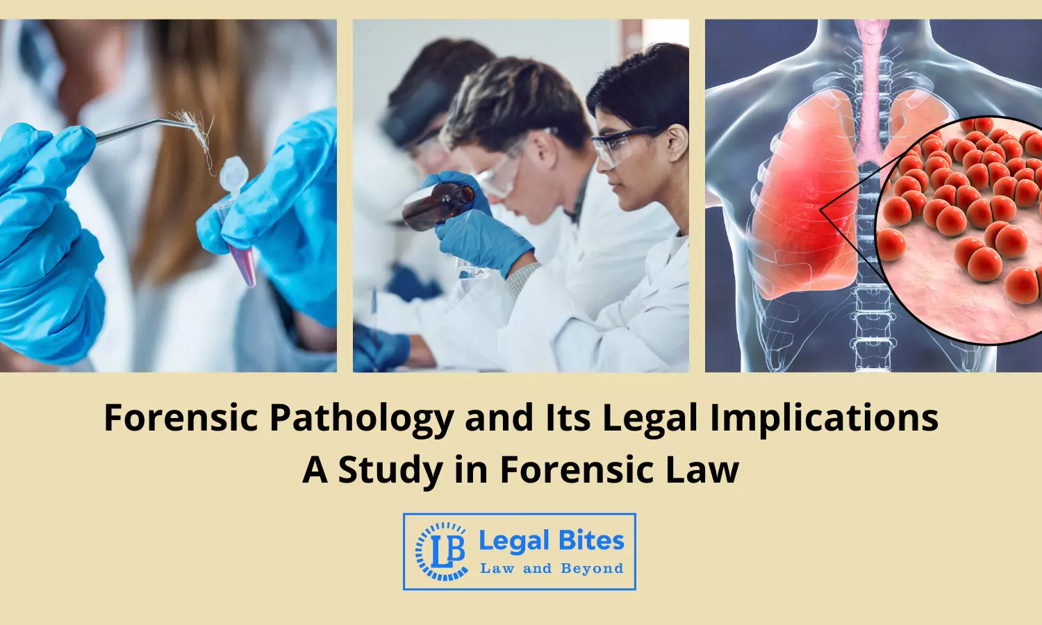 Forensic Pathology and Its Legal Implications: A Study in Forensic Law Forensic Pathology and Its Legal Implications: A Study in Forensic Law
